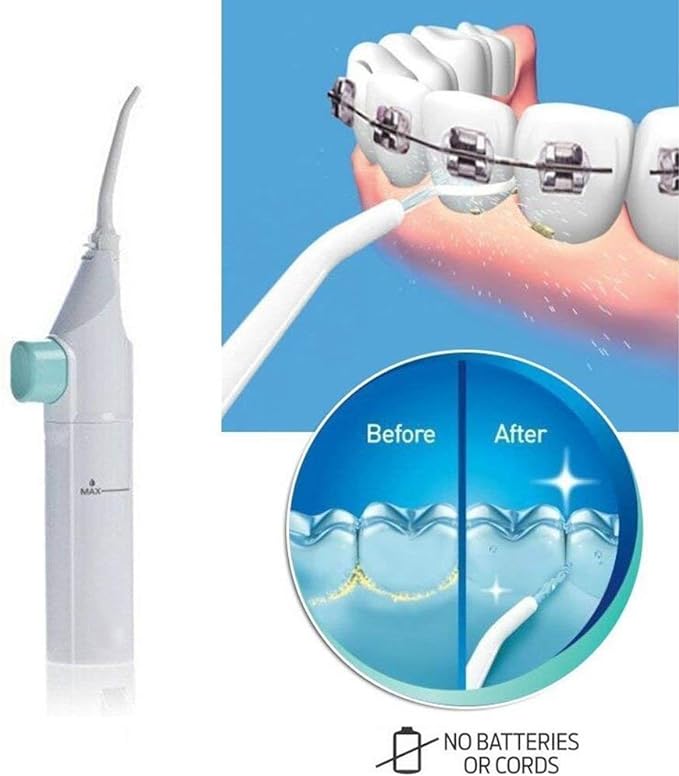 Dental Water Flosser - CITI SOUQ