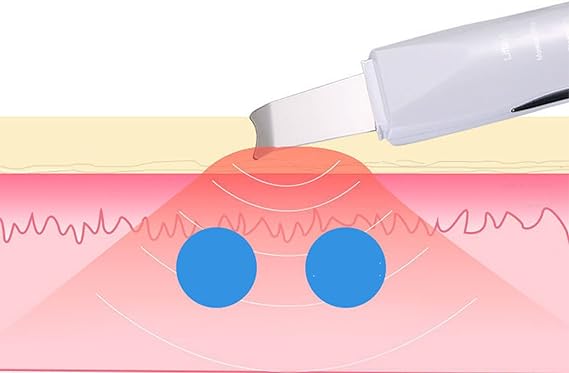 Face Blackhead Remover - CITI SOUQ